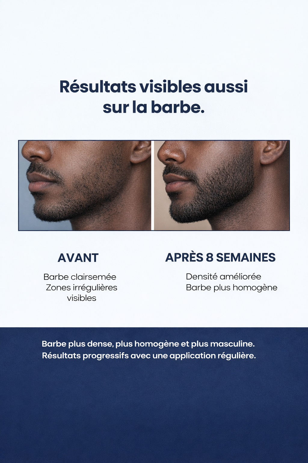 Rehaire – Sérum Roll-On Anti-Calvitie • Repousse en 90 jours