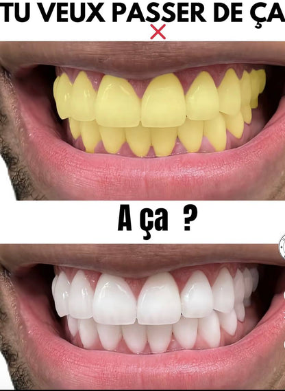 SmileGlow- Pack Dentrifrce Blanchissant probiotique(Élimine des années de taches)